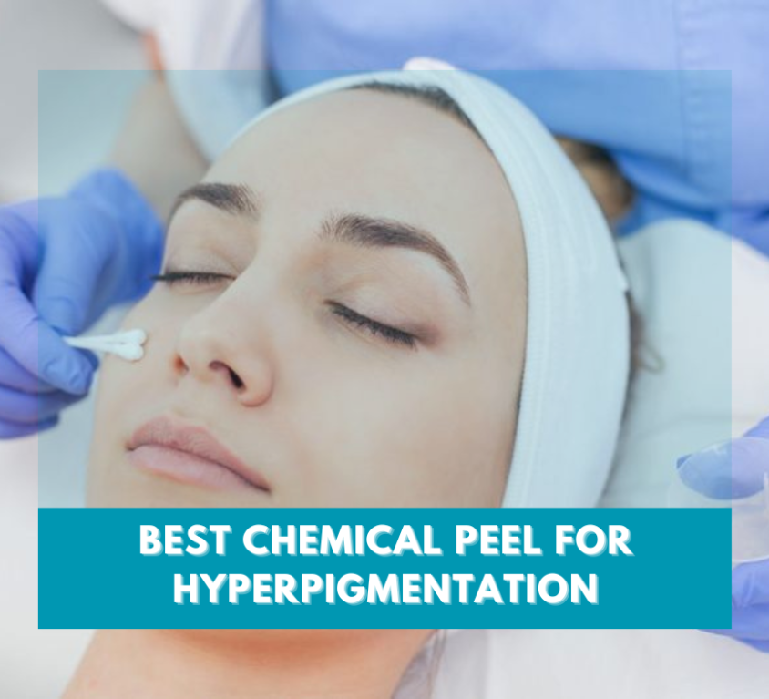 Best Chemical Peel for Hyperpigmentation - Feature