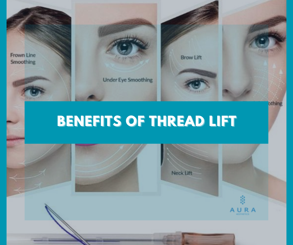 Benefits of Thread Lift