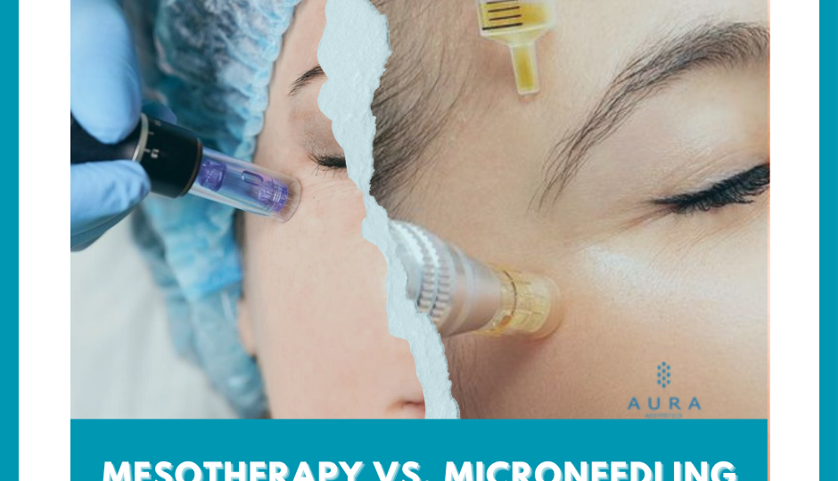Mesotherapy vs. Microneedling
