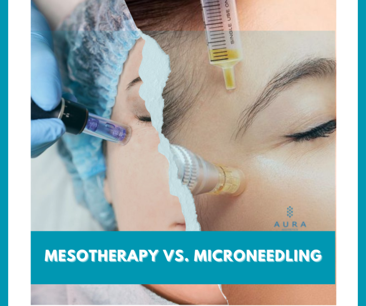 Mesotherapy Vs. Microneedling In 2024 - Aura Aesthetics