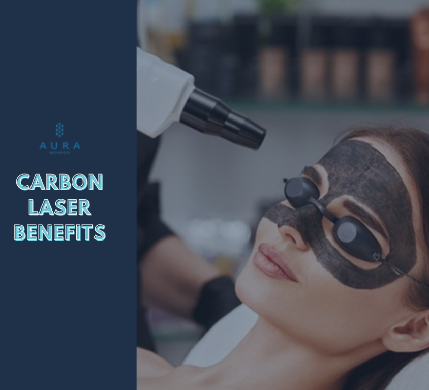 Carbon Laser Benefits